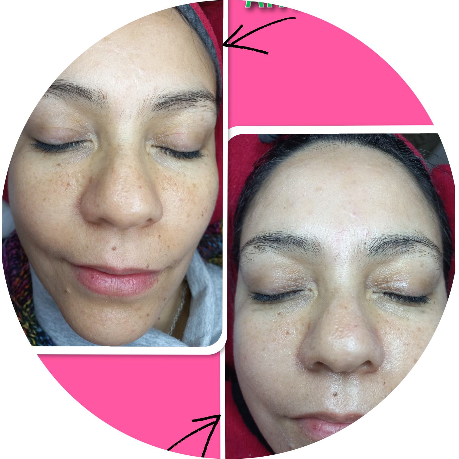 Limpieza profunda facial